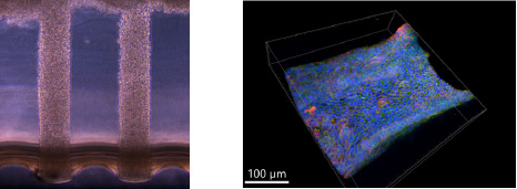 Fabricating in vitro human tissues for disease modeling and drug discovery. First image: Kidney precursor cells spatially patterned in a 3D hydrogel. Second image: Perfusable kidney collecting duct on-chip derived from patient cells (3D reconstruction of one wall of a cylindrical channel shown).